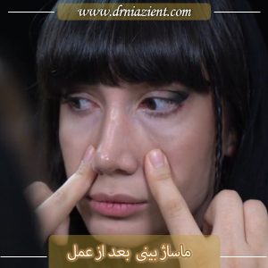 ماساژ بینی بعد عمل - دکتر نیازی