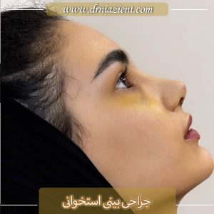 جراحی بینی استخوانی در کرج  - دکتر معصومه نیازی