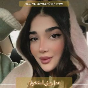 عمل بینی استخوانی در کرج  - دکتر معصومه نیازی
