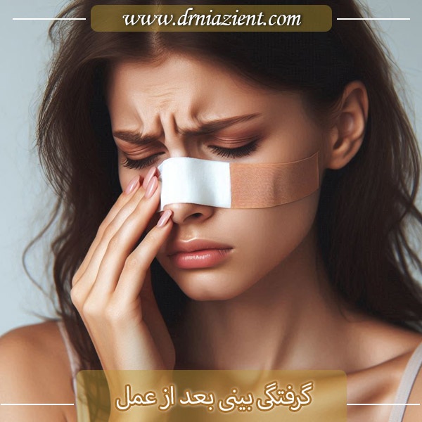 گرفتگی بینی بعد از عمل - دکتر نیازی