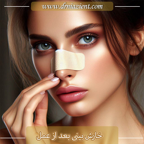 خارش بینی بعد از عمل - دکتر معصومه نیازی