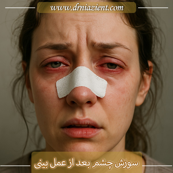 سوزش چشم بعد از عمل بینی | دکتر نیازی