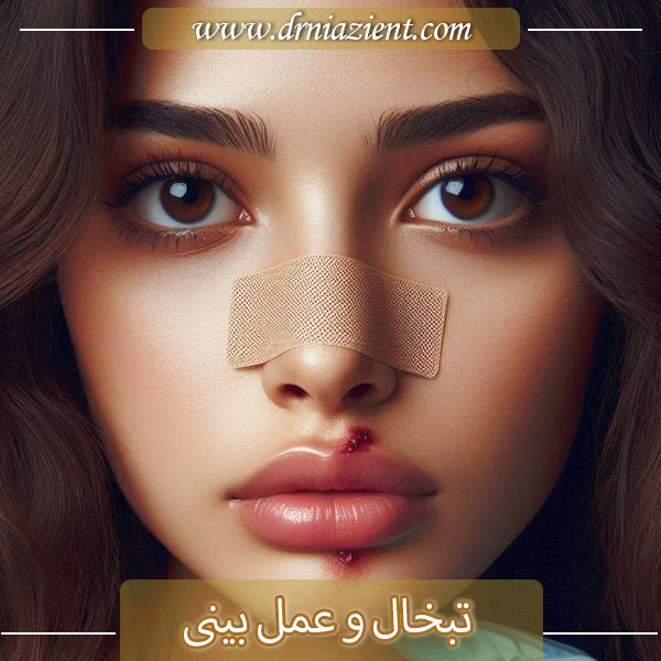 تبخال و عمل بینی - دکتر نیازی