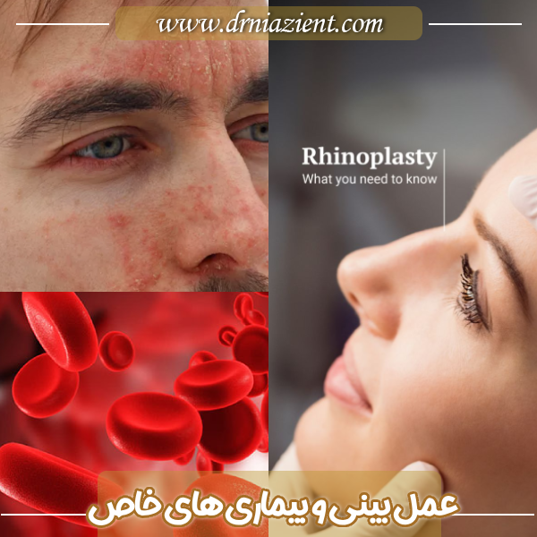 عمل بینی و بیماری های خاص - دکتر معصومه نیازی