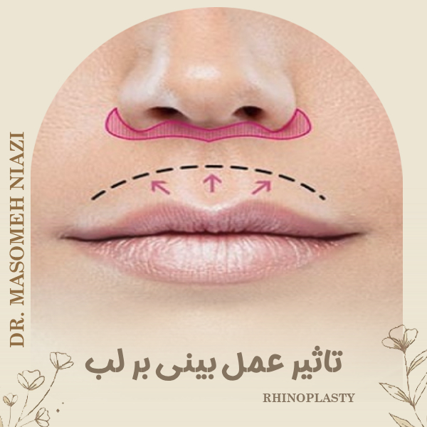 تاثیر عمل بینی بر لب با دکتر معصومه نیازی